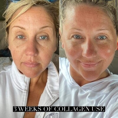Beauty Focus™ Liquid Collagen+