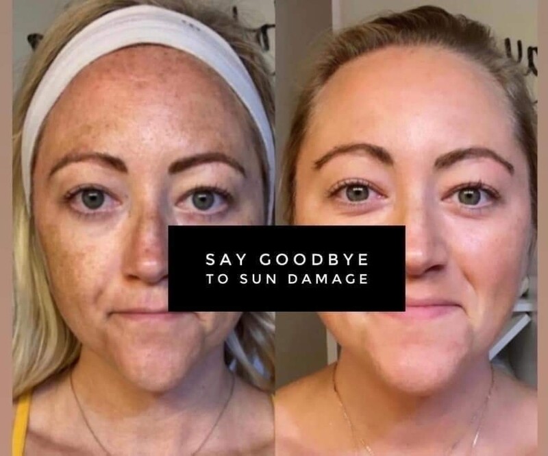 Nu Skin 180°® AHA Facial Peel and Neutralizer