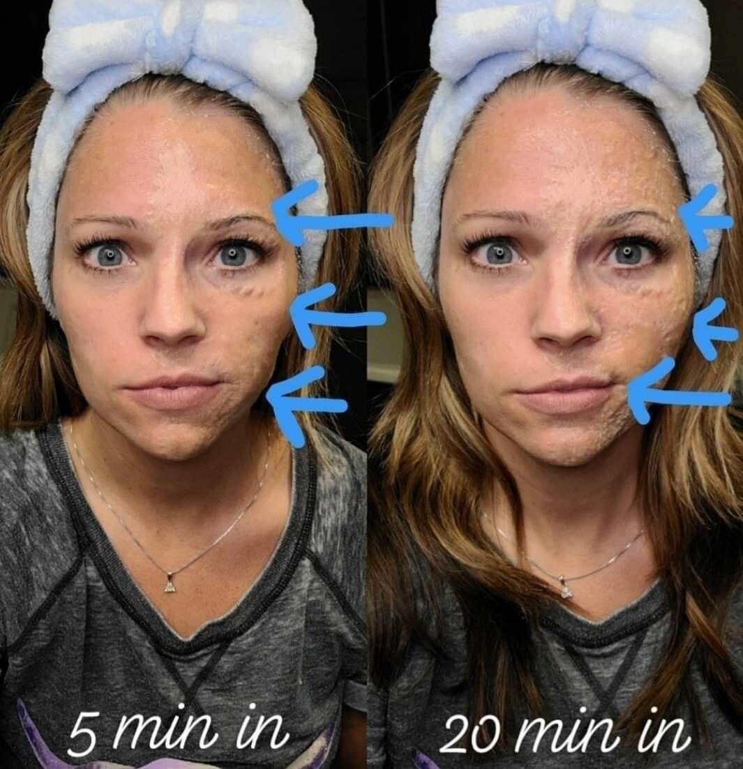 Face Lift with Activator (Original Formula)
