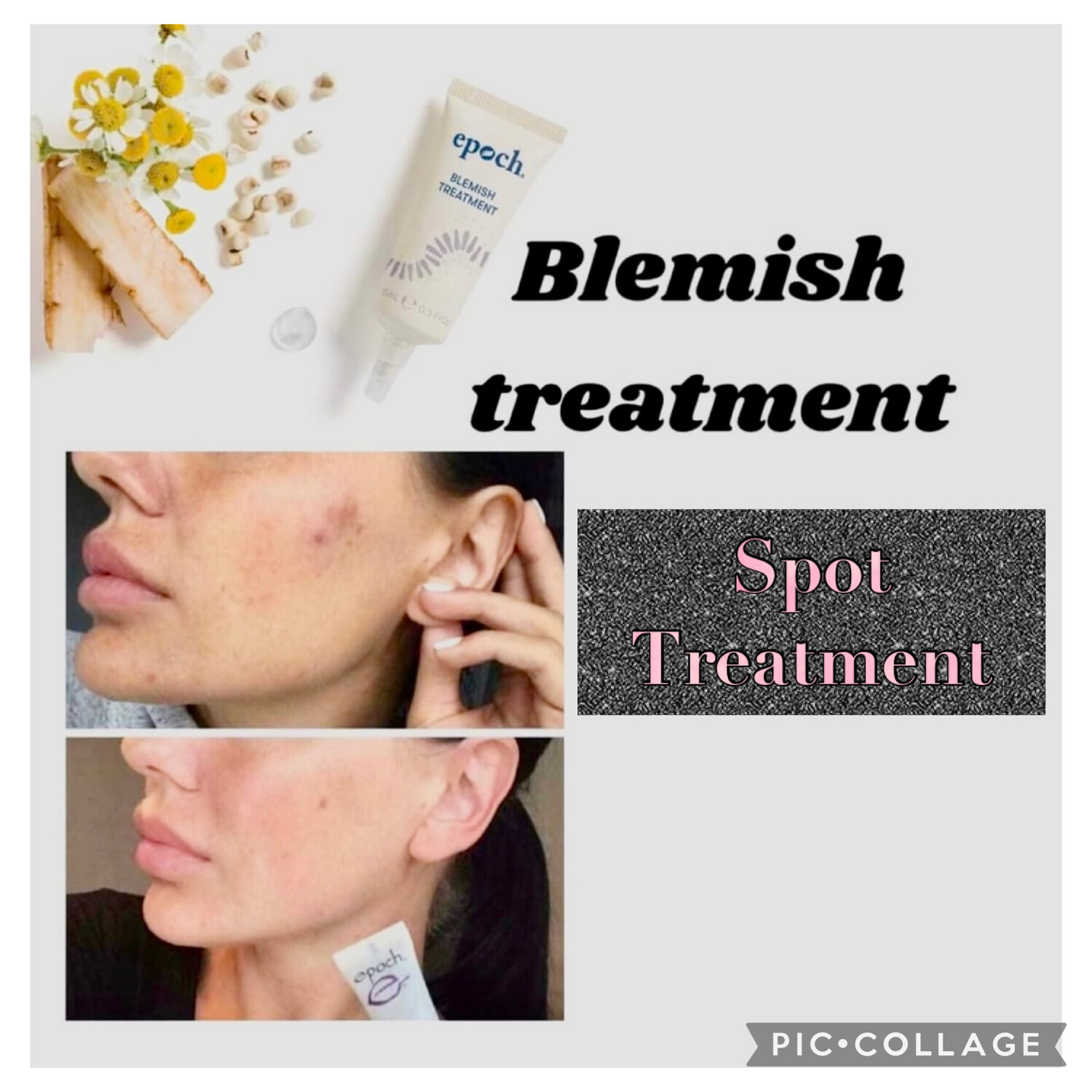 Epoch® Blemish Treatment