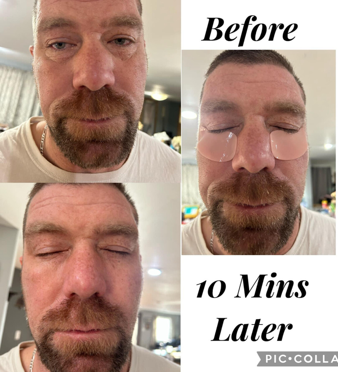 Nutricentials® Hydrating Under Eye Mask