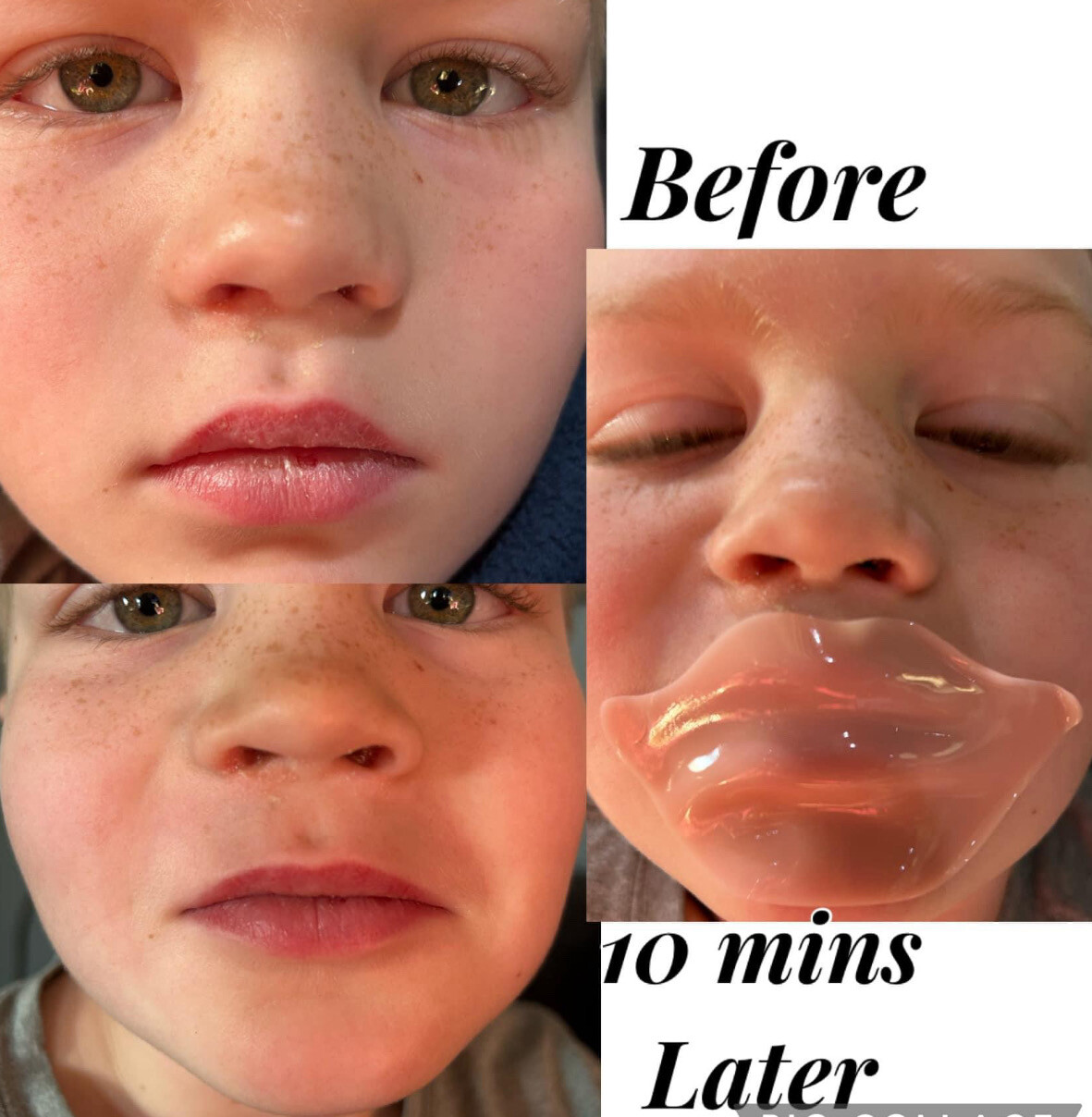 Nutricentials® Hydrating Lip Mask  5 masks