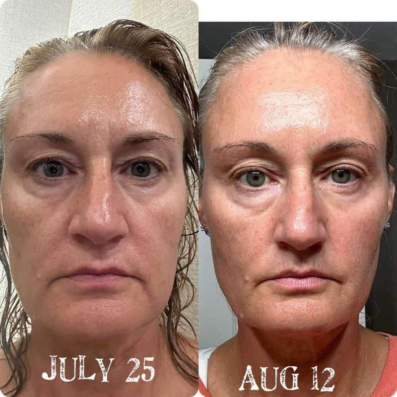 Peptide retinol Complex