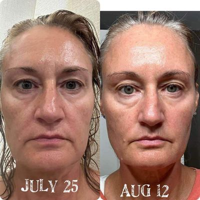 Peptide retinol Complex
