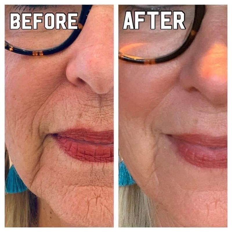 The ULTIMATE Anti-aging Lip Combo