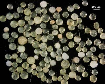 Scutellospora