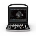 Chison ECO 3 Portable Ultrasound System