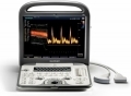 SonoScape S6 Portable Ultrasound System