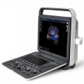 SonoScape S8 Exp Ultrasound System