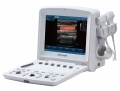 Edan U50 Diagnostic Ultrasound System