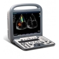 SonoScape S8 Portable Color Doppler Ultrasound System