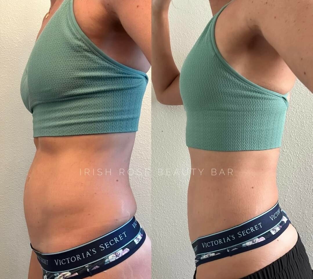 NuEase + Tegreen + free Powdered Collagen sample