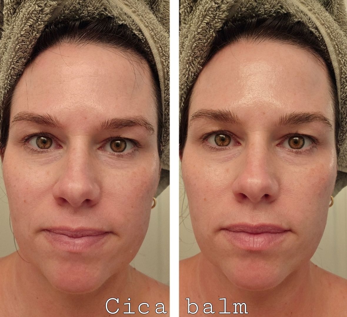 Cica balm