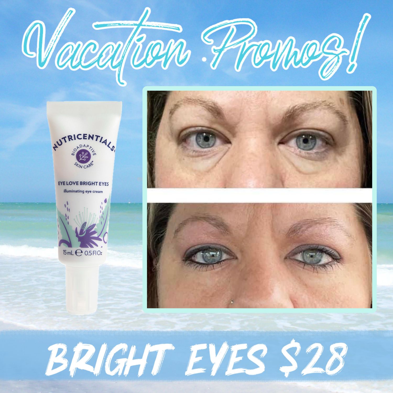 Bright Eyes