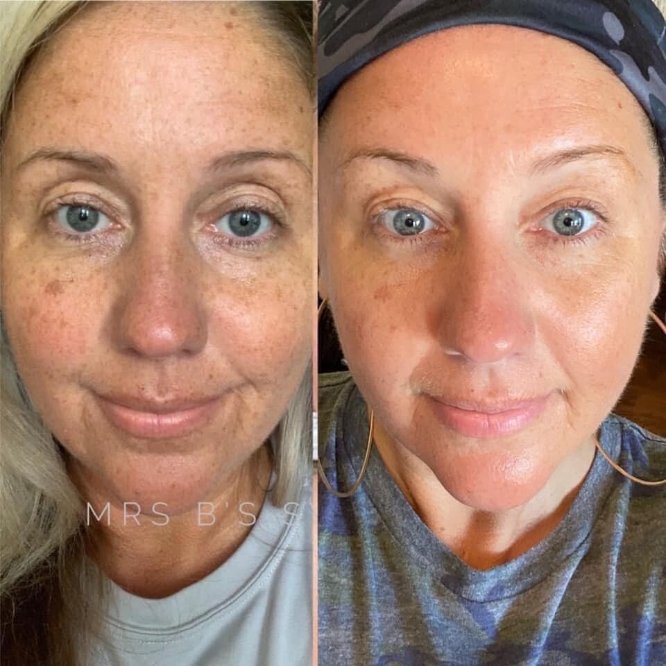 180 Face Wash/Mask