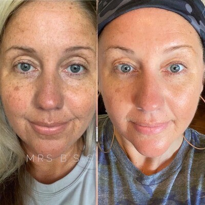 180 Face Wash/Mask