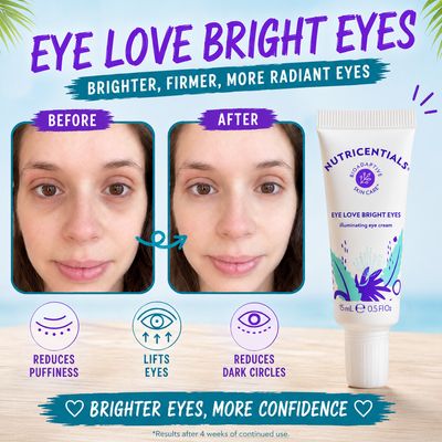 Bright Eyes