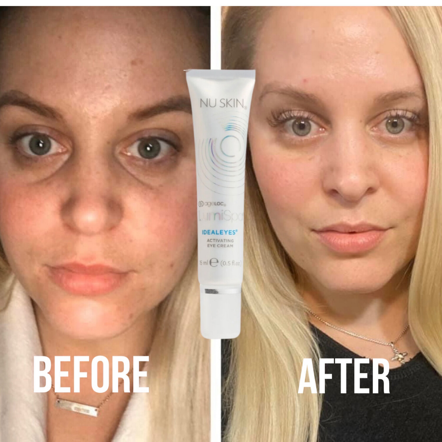 LumiSpa Ideal Eyes