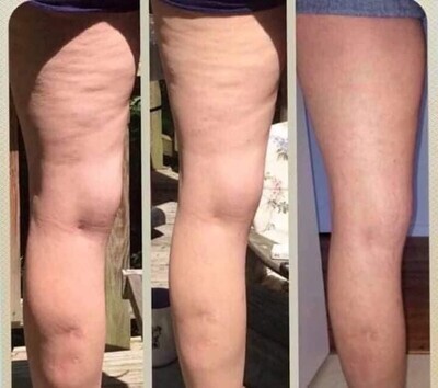 Firming (Cellulite Cream) (save $50 when you buy 2)