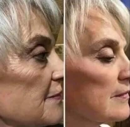 Uplifting Cream