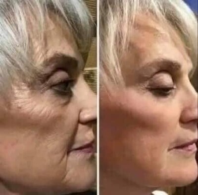 Uplifting Cream