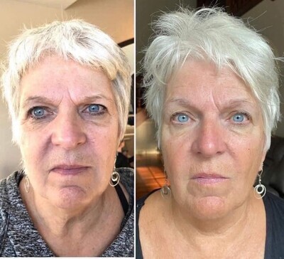 Collagen (Liquid or Powder)