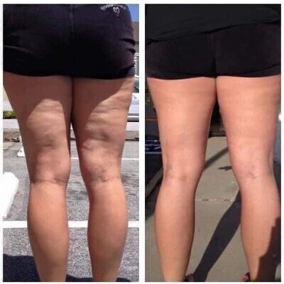 Firming Cream AKA Cellulite Eraser (save $50 when you buy 2)!!