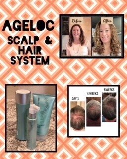 Scalp and Hair System