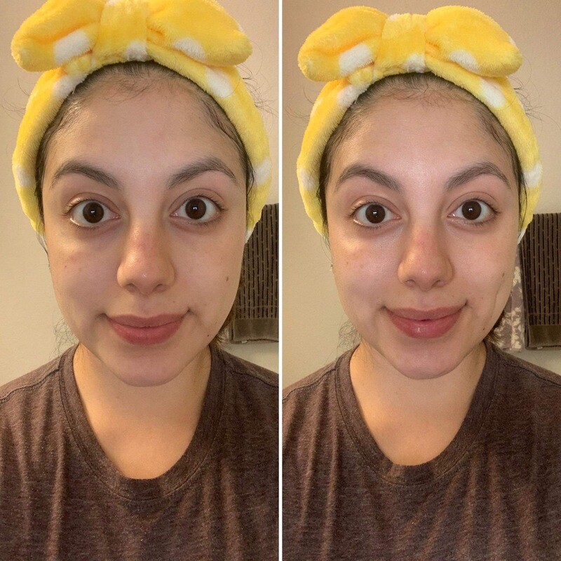 Brightening Serum