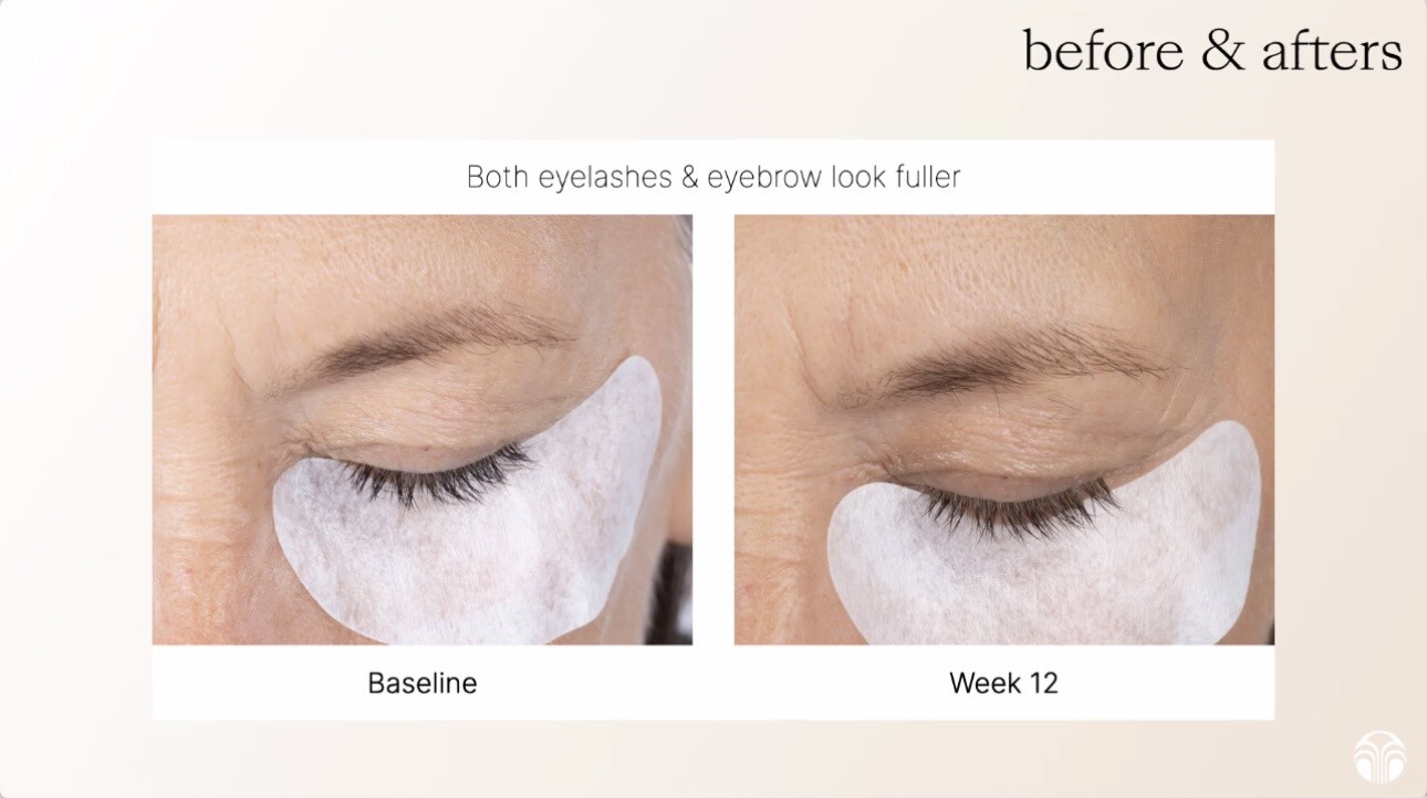 Lash + Brow Serum