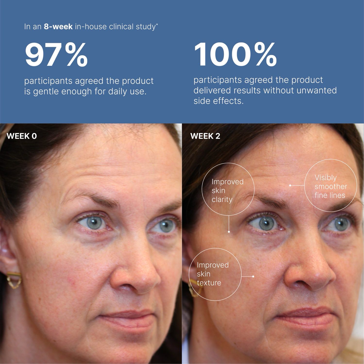 Peptide Retinol Complex