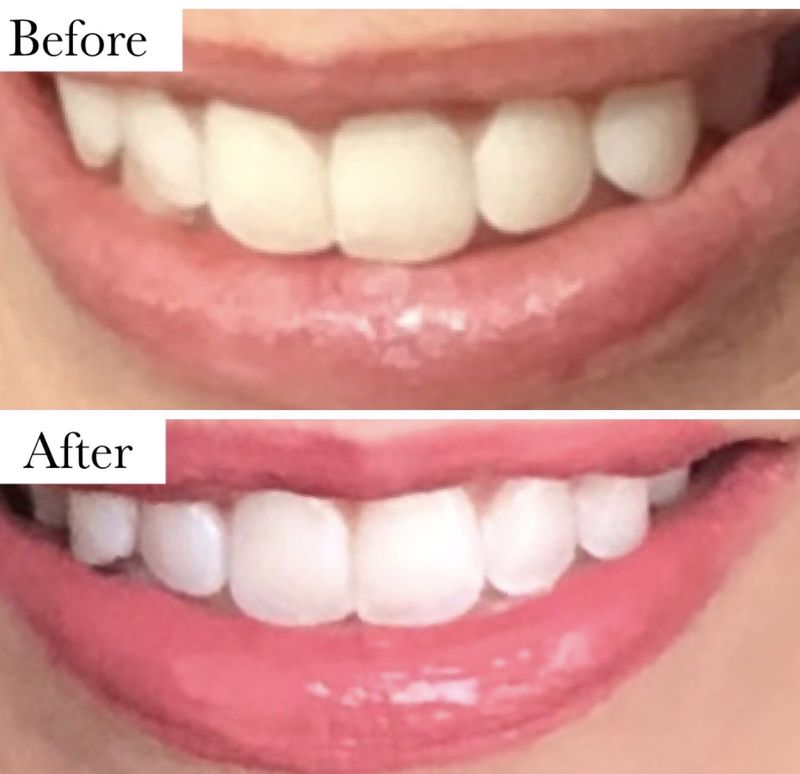 Whitening Toothpaste