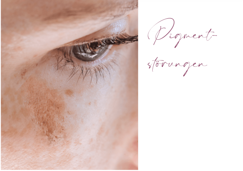 Pigmentstörungen