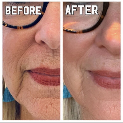TruFace Line Corrector peptide cream