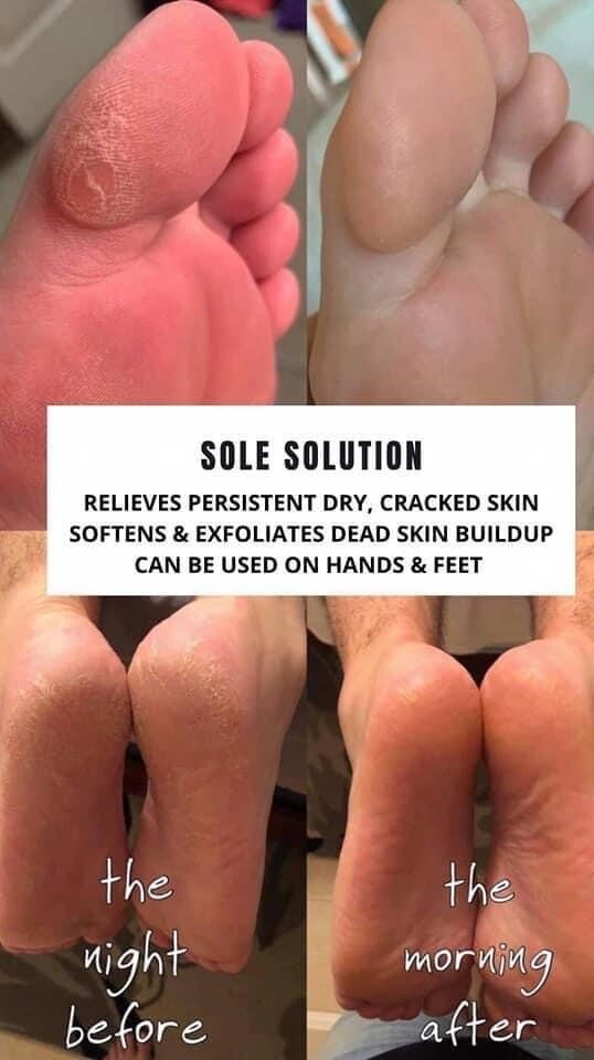 Pedi Cream Sole Solution Sale - Add 2 For The Price Of 1!!