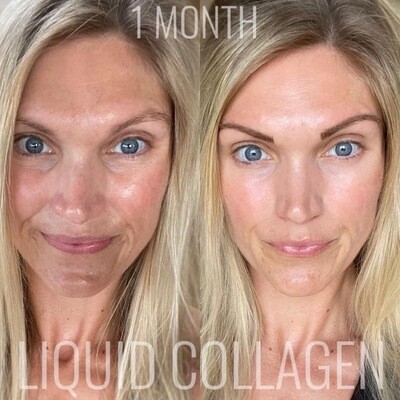 Collagen Collagen