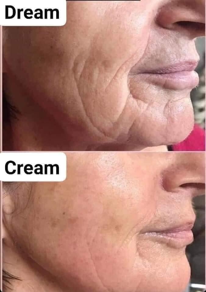 Uplifting Cream