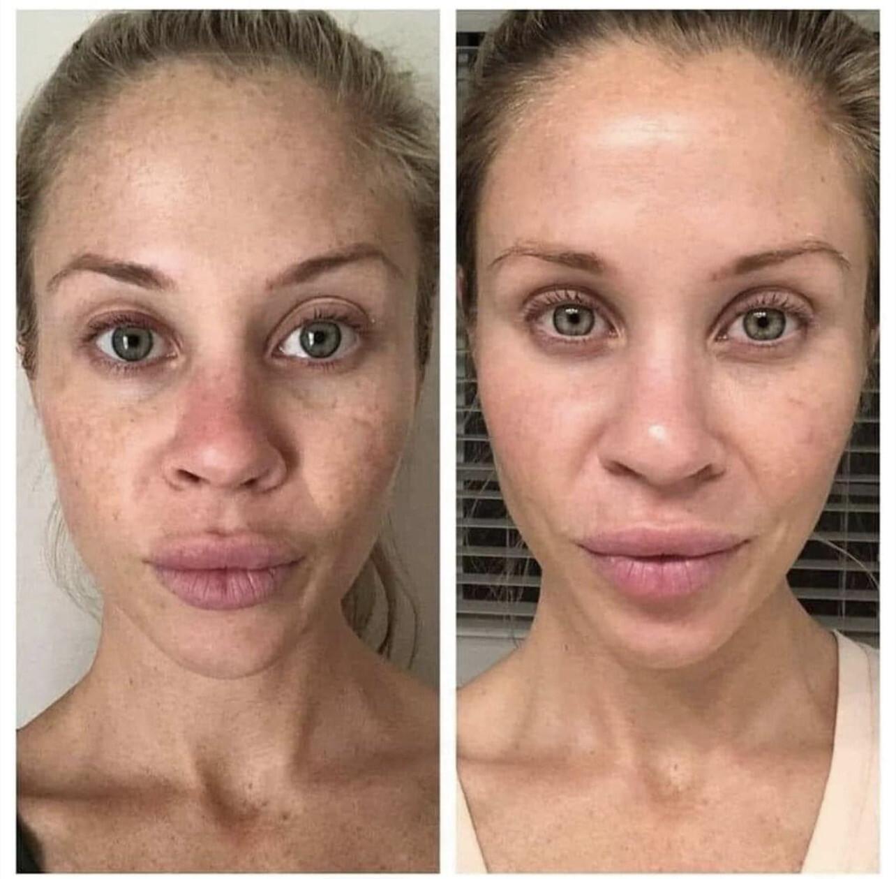 💛💛180 Facial Peel and Neutralizer + 180 Vitamin C Wash Bundle