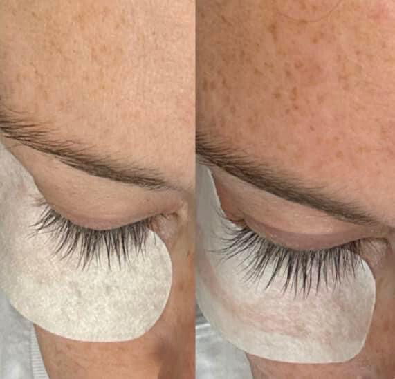 Eye Magic Bundle