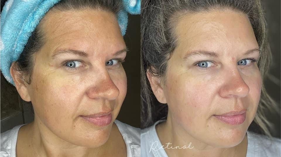 Retinol Peptide Complex
