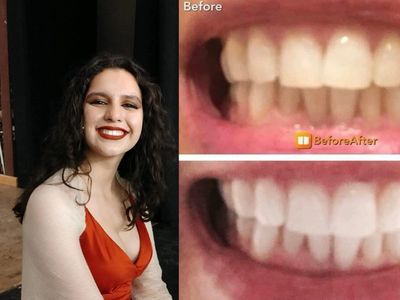 Sofi’s Whitening Toothpaste College Benefit