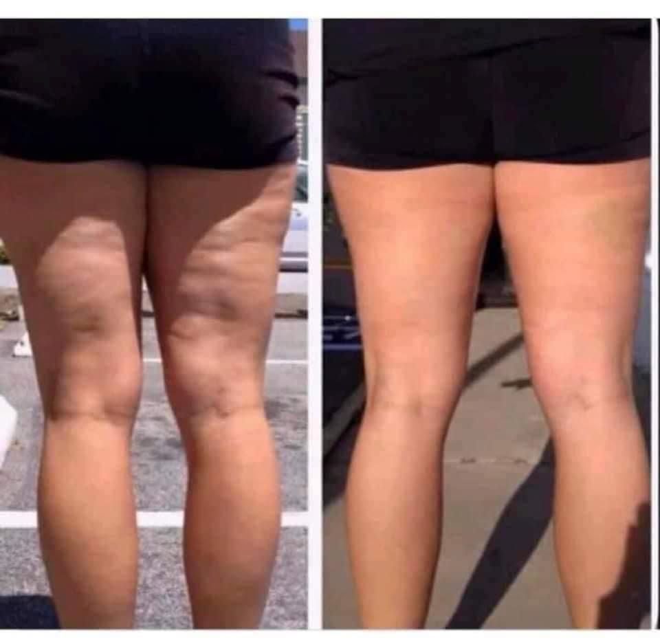 ☀️ Firming /Cellulite Cream