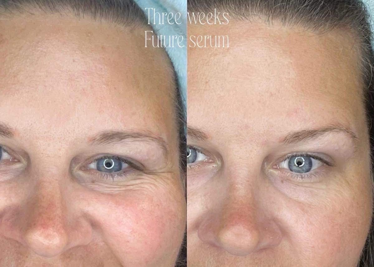 Future Serum + Retinol