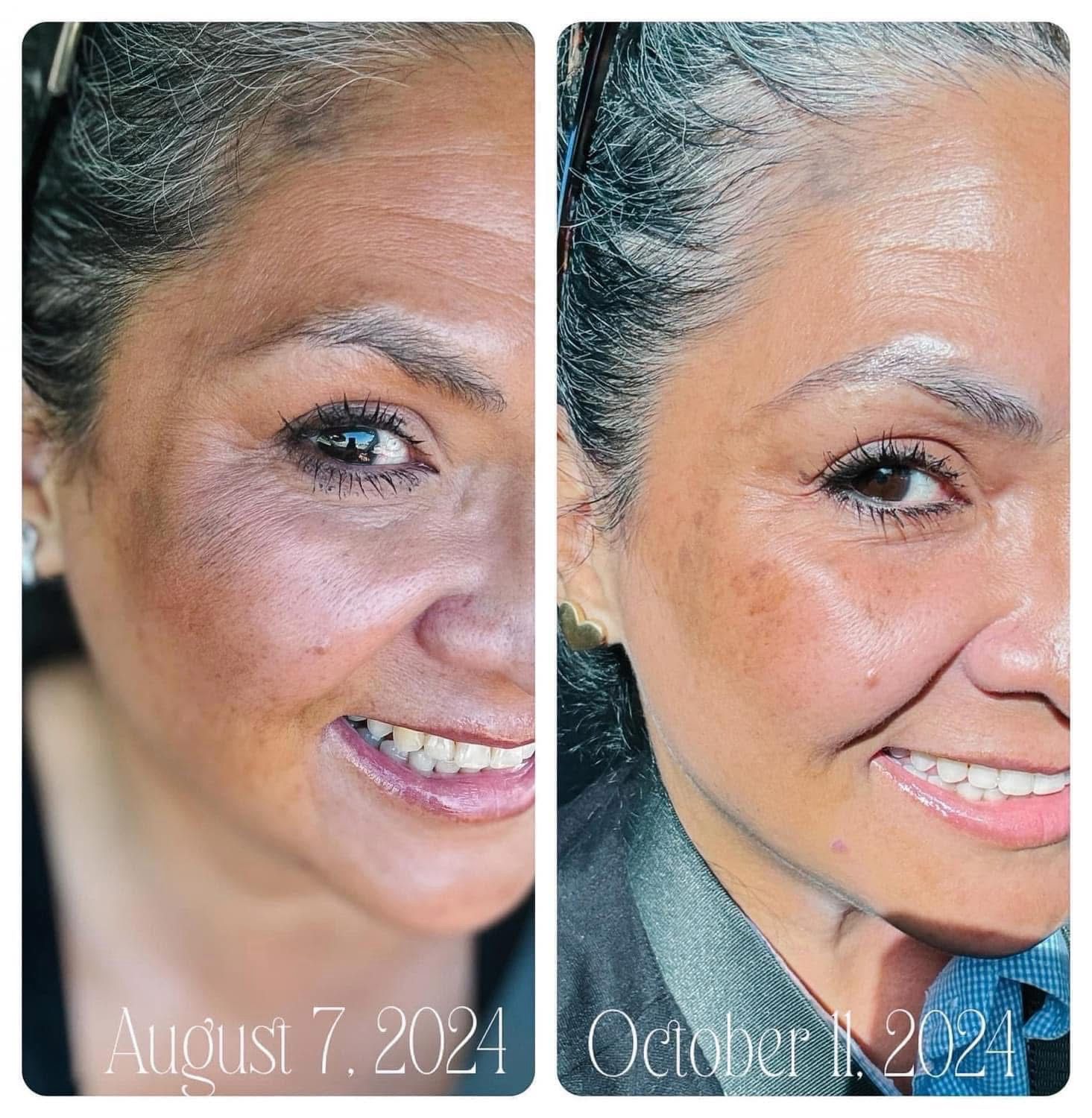 Future Serum + Retinol + Uplifting Cream