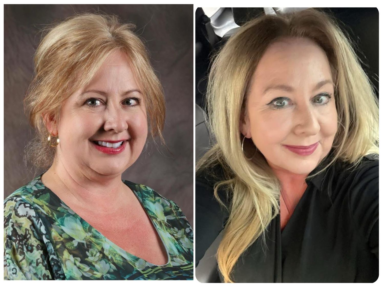 Hair &amp;Scalp System: Shampoo Conditioner &amp; Serum