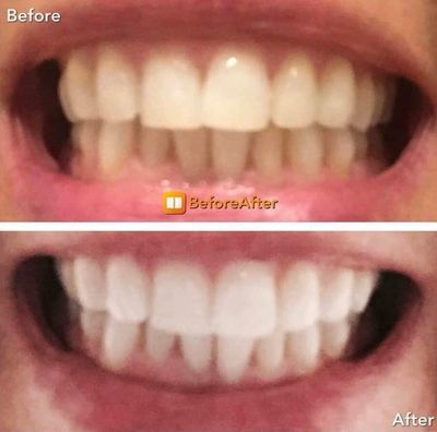 Whitening Toothpaste 🤍