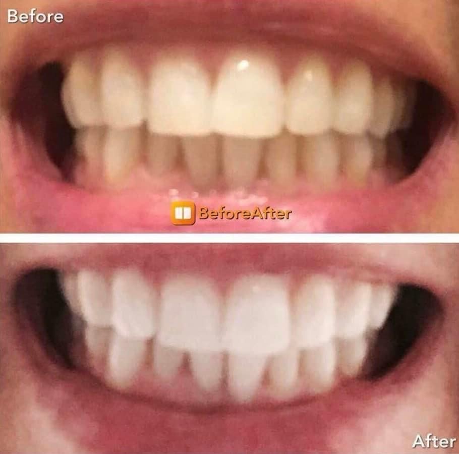 Whitening Toothpaste 🤍
