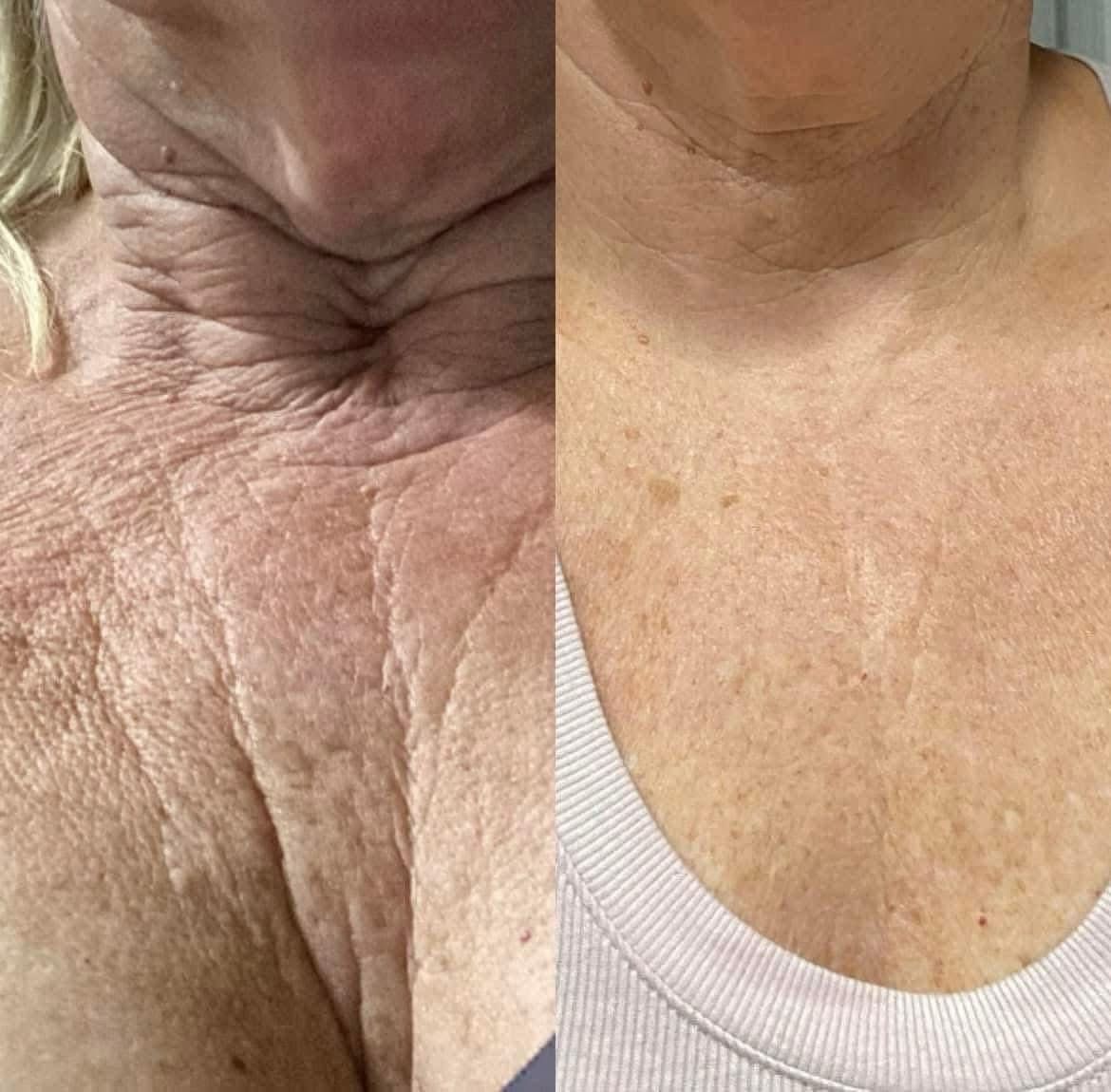 Firming Cream / Cellulite Cream Frieda