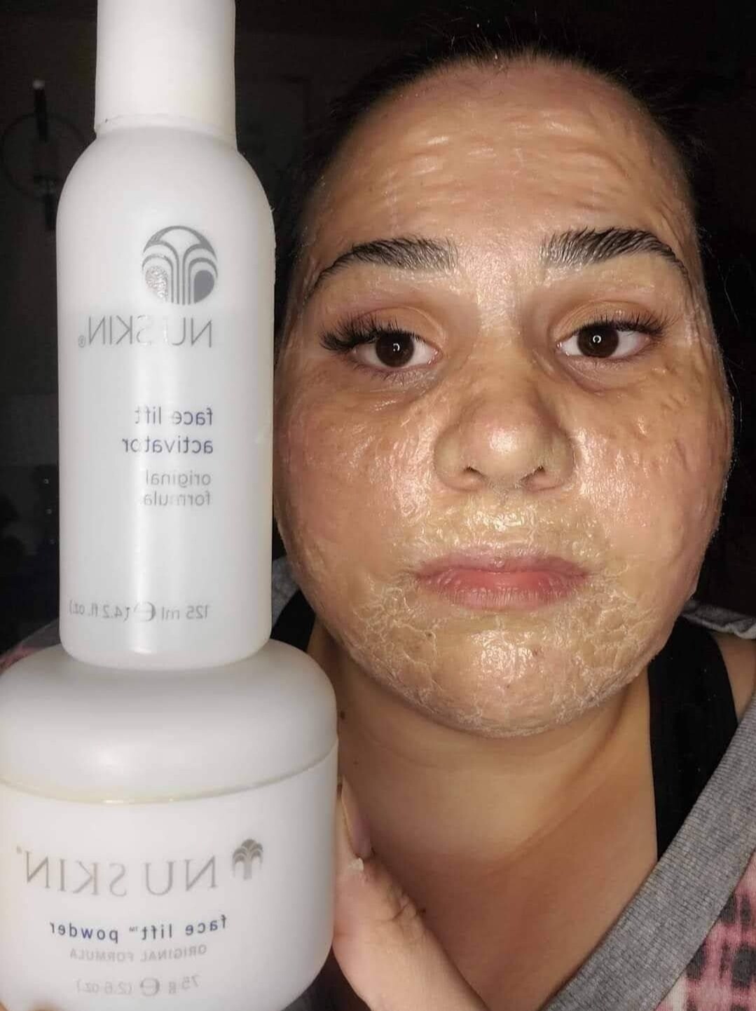 Facelift with Activator