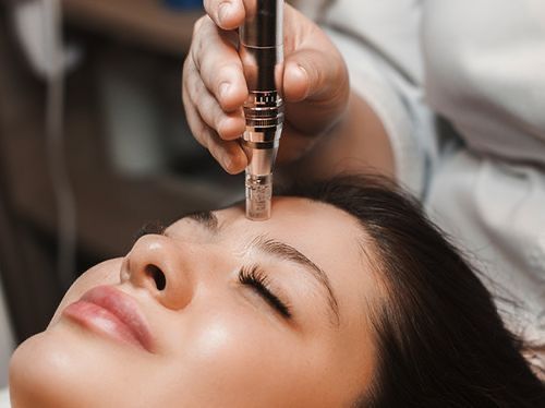 SKIN NEEDLING -6